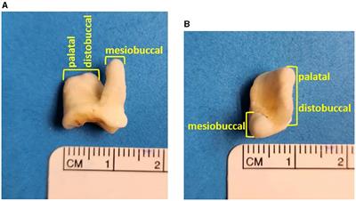 Prevalence of root fusion in canine maxillary second molar teeth using cone-beam computed tomography